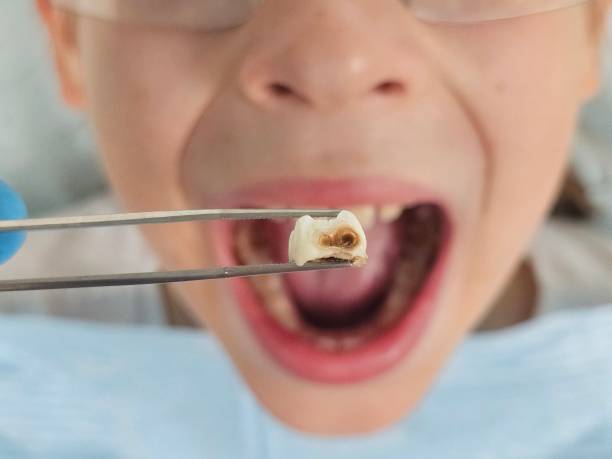 Best Emergency Pediatric Dentist  in Pine Ridge, PA