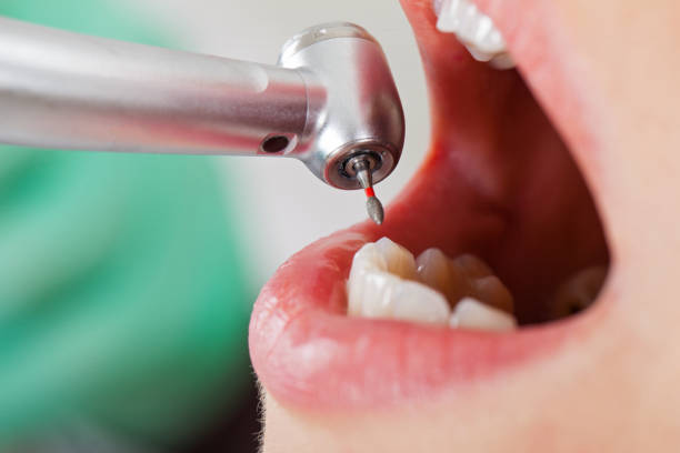 Best Urgent Tooth Repair  in Pine Ridge, PA
